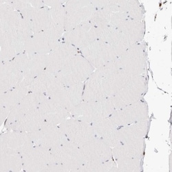 Transketolase Antibody, Novus Biologicals 0.1mL; Unlabeled:Antibodies,