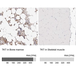 Transketolase Antibody, Novus Biologicals 0.1mL; Unlabeled:Antibodies,
