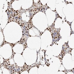 Transketolase Antibody, Novus Biologicals 25 &mu;L; Unlabeled:Antibodies,