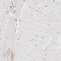 Transketolase Antibody, Novus Biologicals 25 &mu;L; Unlabeled:Antibodies,