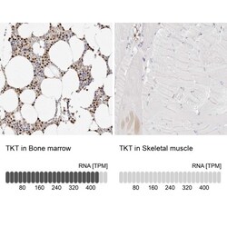 Transketolase Antibody, Novus Biologicals 25 &mu;L; Unlabeled:Antibodies,