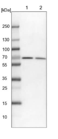 Transketolase Antibody, Novus Biologicals 0.1mL; Unlabeled:Antibodies,