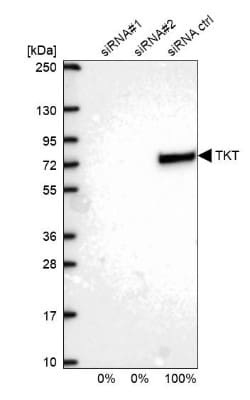 Transketolase Antibody, Novus Biologicals 0.1mL; Unlabeled:Antibodies,