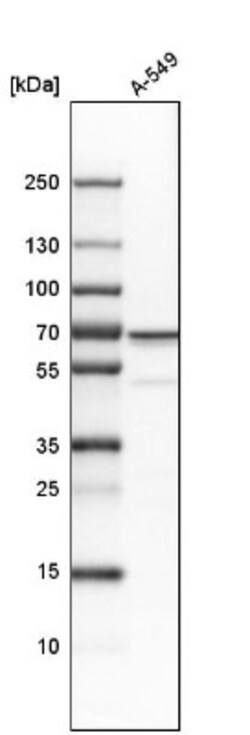 Transketolase Antibody, Novus Biologicals 25 &mu;L; Unlabeled:Antibodies,