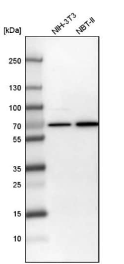 Transketolase Antibody, Novus Biologicals 25 &mu;L; Unlabeled:Antibodies,