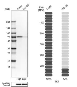 Transketolase Antibody, Novus Biologicals 25 &mu;L; Unlabeled:Antibodies,
