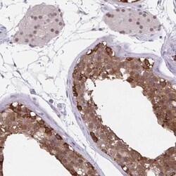 Translin Antibody, Novus Biologicals 0.1mL; Unlabeled:Antibodies, Polyclonal
