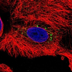 Transthyretin/Prealbumin Antibody, Novus Biologicals 0.1mL; Unlabeled:Antibodies,