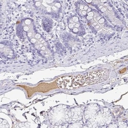 Transthyretin/Prealbumin Antibody, Novus Biologicals 0.1mL; Unlabeled:Antibodies,