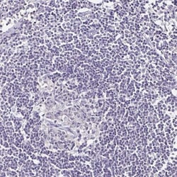 Transthyretin/Prealbumin Antibody, Novus Biologicals 0.1mL; Unlabeled:Antibodies,