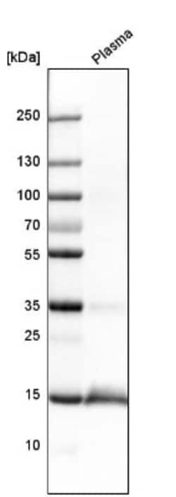Transthyretin/Prealbumin Antibody, Novus Biologicals 0.1mL; Unlabeled:Antibodies,