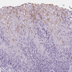 Trappin-2/Elafin/Skalp Antibody, Novus Biologicals:Antibodies:Primary Antibodies