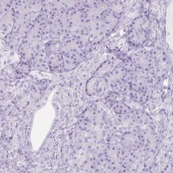 Trappin-2/Elafin/Skalp Antibody, Novus Biologicals:Antibodies:Primary Antibodies
