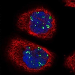 Treacher Collins syndrome protein Antibody, Novus Biologicals 0.1mL; Unlabeled:Antibodies,