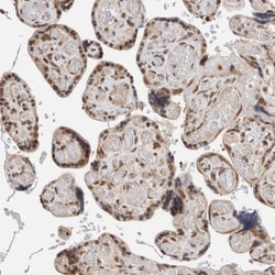Trinucleotide Repeat Containing 18 Antibody, Novus Biologicals 0.1mL; Unlabeled:Antibodies,