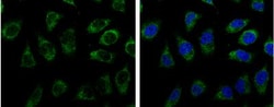 Triosephosphate isomerase Antibody, Novus Biologicals 0.1mg; Unlabeled:Antibodies,