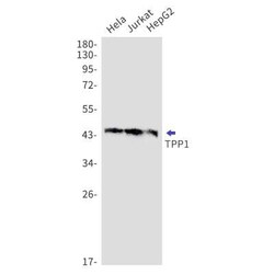 Tripeptidyl-Peptidase I/TPP1 Rabbit anti-Human, Mouse, Rat, Clone: S09-2G9,