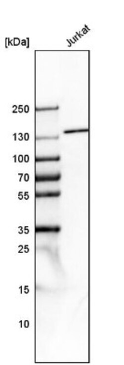 Tripeptidyl peptidase II Antibody, Novus Biologicals:Antibodies:Primary
