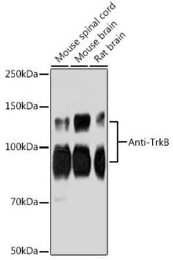 TrkB Rabbit anti-Mouse, Rat, Clone: 1D7U4, Novus Biologicals:Antibodies:Primary