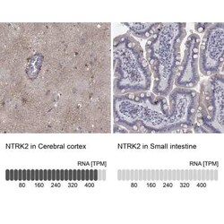 TrkB Rabbit anti-Human, Polyclonal, Novus Biologicals 25 &mu;g; Unconjugated:Antibodies,