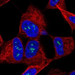 Tropomodulin 2 Antibody, Novus Biologicals 0.1mL; Unlabeled:Antibodies,