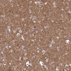 Tropomodulin 2 Antibody, Novus Biologicals 0.1mL; Unlabeled:Antibodies,
