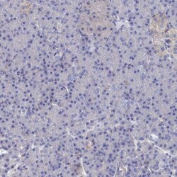Tropomodulin 2 Antibody, Novus Biologicals 0.1mL; Unlabeled:Antibodies,