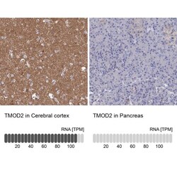 Tropomodulin 2 Antibody, Novus Biologicals 0.1mL; Unlabeled:Antibodies,