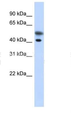 Tropomodulin 2 Antibody, Novus Biologicals 100&mu;L; Unlabeled:Antibodies,