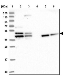 Tropomodulin 2 Antibody, Novus Biologicals 0.1mL; Unlabeled:Antibodies,