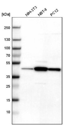 Tropomodulin 3 Antibody, Novus Biologicals 0.1 mL | Buy Online | Novus Biologicals | Fisher Scientific