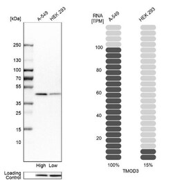 Tropomodulin 3 Antibody, Novus Biologicals 0.1 mL | Buy Online | Novus Biologicals | Fisher Scientific