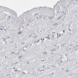 Tropomodulin 4 Antibody, Novus Biologicals:Antibodies:Primary Antibodies