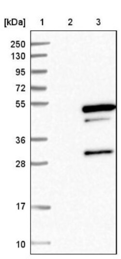 Tropomodulin 4 Antibody, Novus Biologicals:Antibodies:Primary Antibodies
