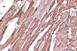 Tropomyosin-1 Rabbit anti-Mouse, Rat, Clone: 5Q2H6, Novus Biologicals 100