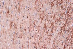 Tropomyosin-1 Rabbit anti-Mouse, Rat, Clone: 5Q2H6, Novus Biologicals 100