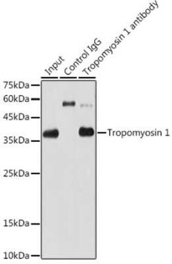 Tropomyosin-1 Rabbit anti-Mouse, Rat, Clone: 5Q2H6, Novus Biologicals 100