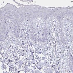 Troponin C (cardiac) Antibody, Novus Biologicals 0.1mL; Unlabeled:Antibodies,