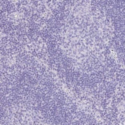 Troponin T type 1 (slow skeletal) Antibody, Novus Biologicals 0.1mL; Unlabeled:Antibodies,