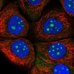 TrpC2-like protein Antibody, Novus Biologicals 0.1mL; Unlabeled:Antibodies,