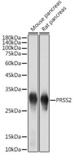 Trypsin 2/PRSS2 Rabbit anti-Human, Mouse, Rat, Clone: 3D9O7, Novus Biologicals:Antibodies:Primary