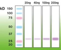 Rabbit anti-Trypsin 1/PRSS1, Clone: A16-N, Novus Biologicals 0.05mL; Unlabeled:Antibodies,