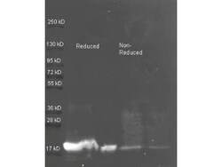 Trypsin Inhibitor Antibody, Novus Biologicals 0.1 mg | Buy Online | Novus Biologicals | Fisher Scientific