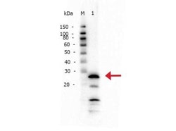 Trypsin 1/PRSS1 Antibody, Novus Biologicals 100ug:Antibodies, Polyclonal
