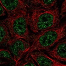 Tryptase epsilon/BSSP-4/PRSS22 Antibody, Novus Biologicals 25 &mu;L, Unlabeled:Antibodies,