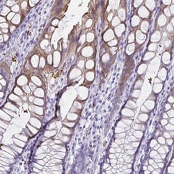 Tryptase gamma-1/TPSG1 Antibody, Novus Biologicals 0.1mL; Unlabeled:Antibodies,