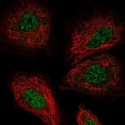 Tsukushi/TSK Antibody, Novus Biologicals 25 &mu;L; Unlabeled:Antibodies,