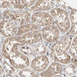 Tsukushi/TSK Antibody, Novus Biologicals 25 &mu;L; Unlabeled:Antibodies,
