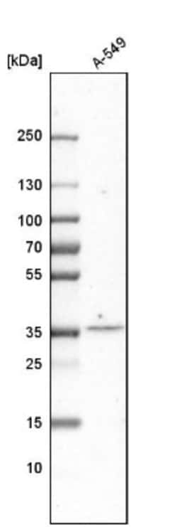 Tsukushi/TSK Antibody, Novus Biologicals 25 &mu;L; Unlabeled:Antibodies,