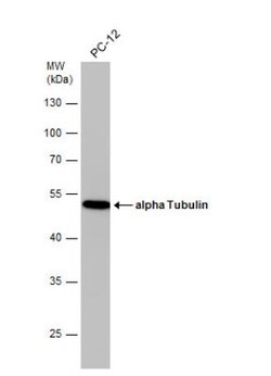 Tubulin alpha-1B Antibody (114), Novus Biologicals 0.1 mL | Buy Online | Novus Biologicals | Fisher Scientific